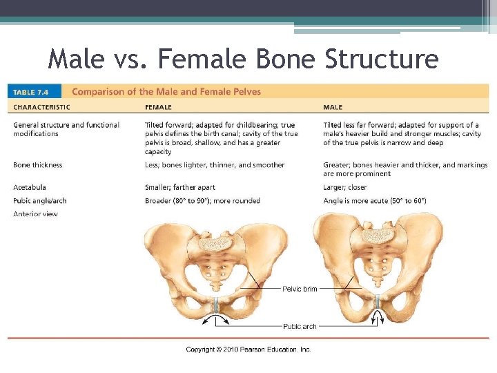 Male vs. Female Bone Structure 