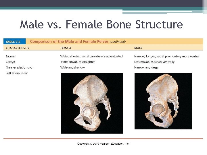 Male vs. Female Bone Structure 