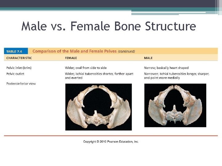 Male vs. Female Bone Structure 