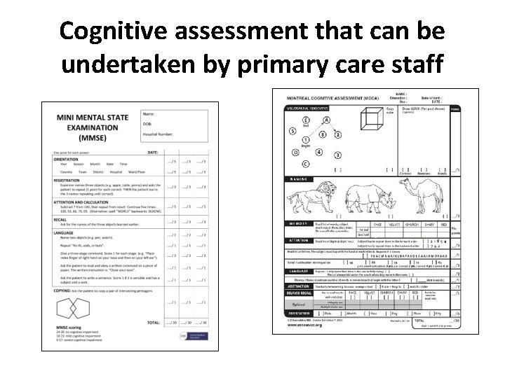 Cognitive assessment that can be undertaken by primary care staff 