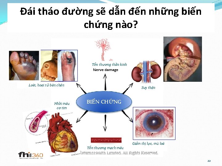 Đái tháo đường sẽ dẫn đến những biến chứng nào? Tổn thương thần kinh