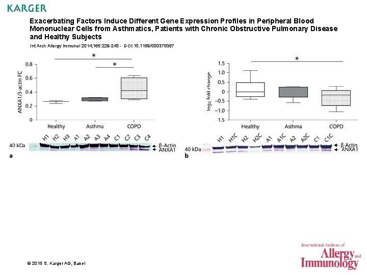 Exacerbating Factors Induce Different Gene Expression Profiles in Peripheral Blood Mononuclear Cells from Asthmatics,