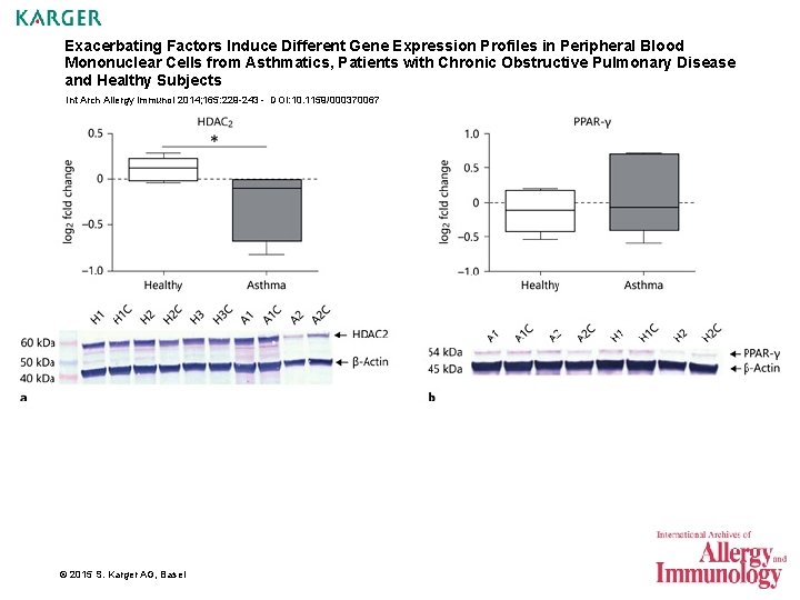 Exacerbating Factors Induce Different Gene Expression Profiles in Peripheral Blood Mononuclear Cells from Asthmatics,