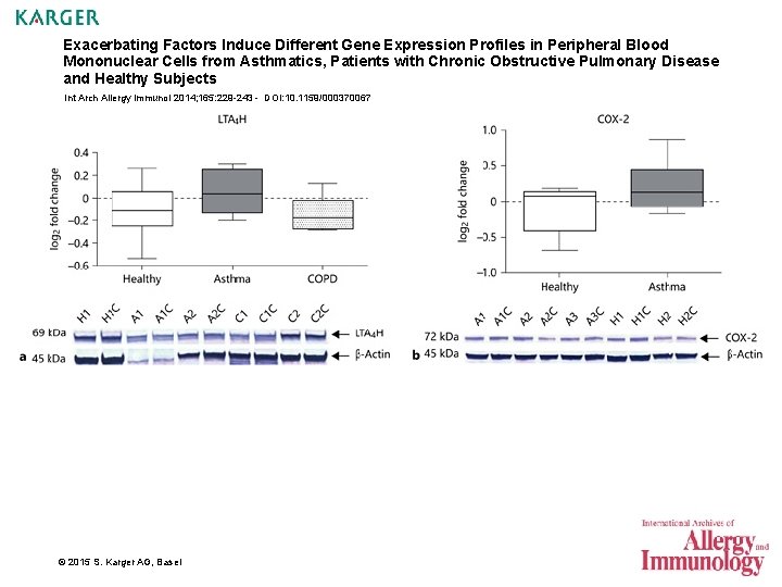 Exacerbating Factors Induce Different Gene Expression Profiles in Peripheral Blood Mononuclear Cells from Asthmatics,