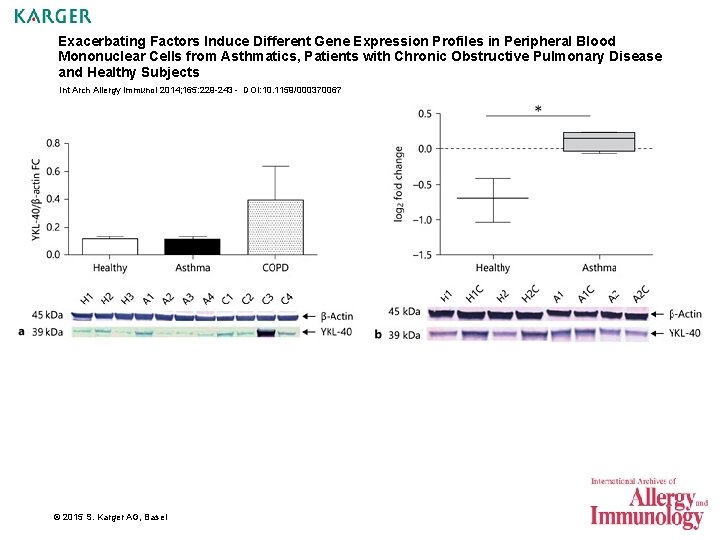 Exacerbating Factors Induce Different Gene Expression Profiles in Peripheral Blood Mononuclear Cells from Asthmatics,