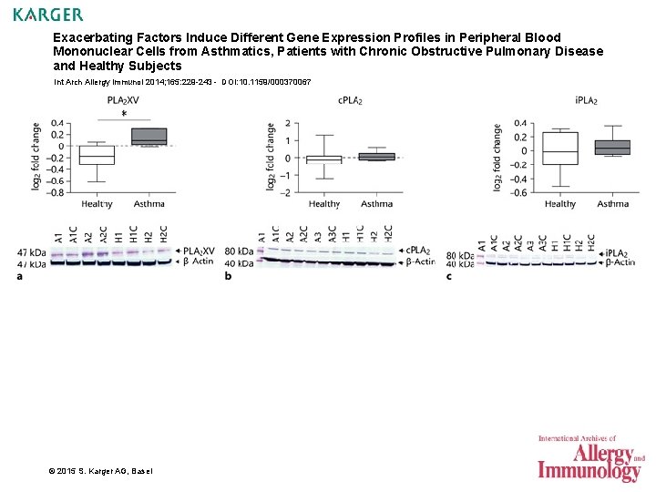 Exacerbating Factors Induce Different Gene Expression Profiles in Peripheral Blood Mononuclear Cells from Asthmatics,