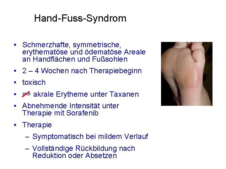 Hand-Fuss-Syndrom • Schmerzhafte, symmetrische, erythematöse und ödematöse Areale an Handflächen und Fußsohlen • 2