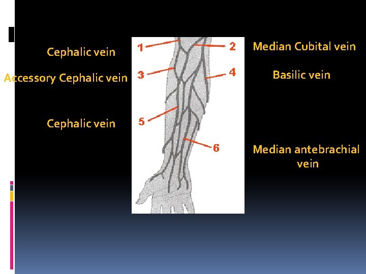 Cephalic vein Accessory Cephalic vein Median Cubital vein Basilic vein Cephalic vein Median antebrachial