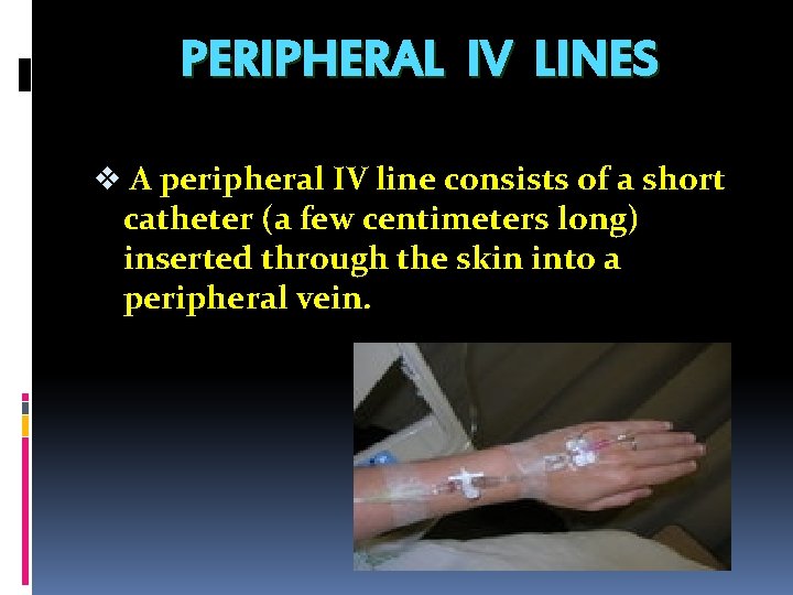 PERIPHERAL IV LINES v A peripheral IV line consists of a short catheter (a