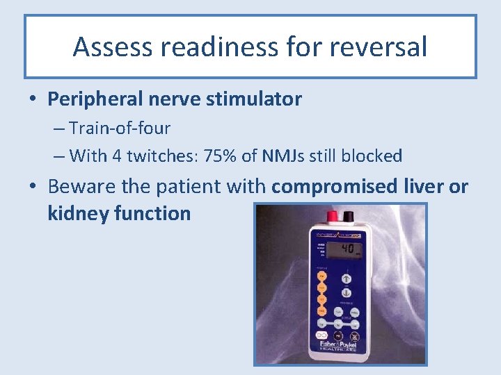 Assess readiness for reversal • Peripheral nerve stimulator – Train-of-four – With 4 twitches: