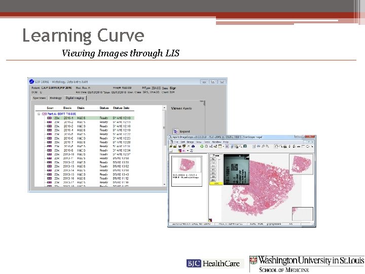 Learning Curve Viewing Images through LIS 
