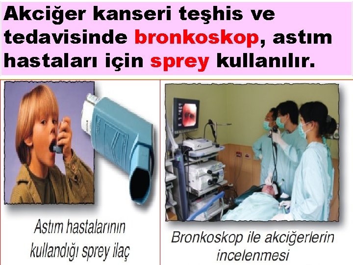 Akciğer kanseri teşhis ve tedavisinde bronkoskop, astım hastaları için sprey kullanılır. 27 