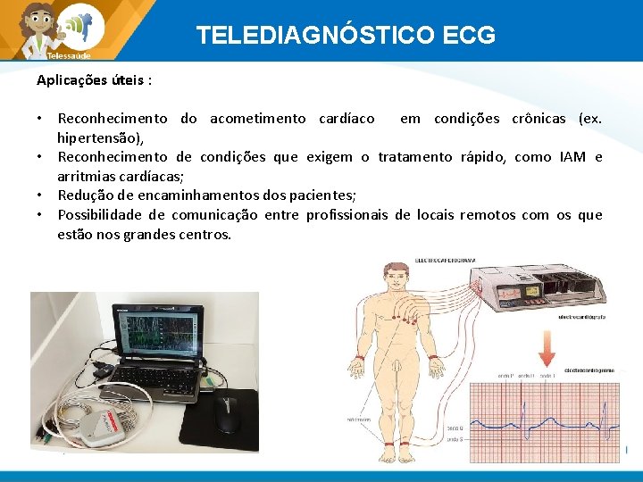 TELEDIAGNÓSTICO ECG Aplicações úteis : • Reconhecimento do acometimento cardíaco em condições crônicas (ex.