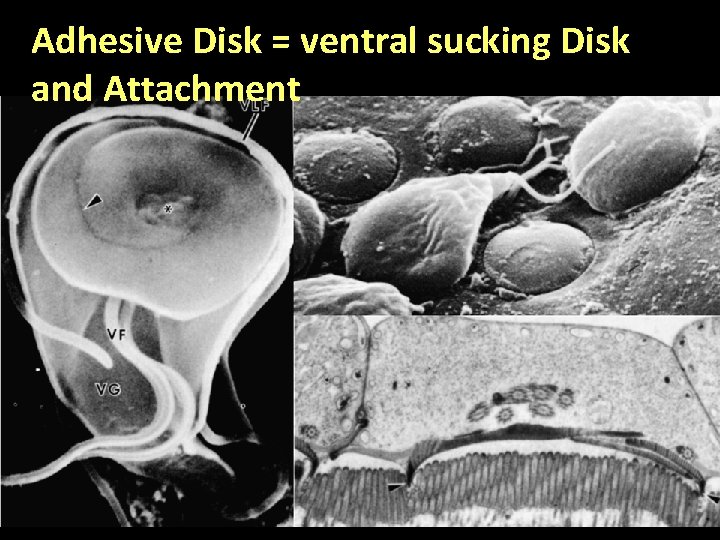 Adhesive Disk = ventral sucking Disk and Attachment 