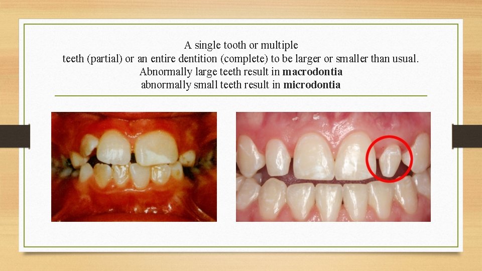 A single tooth or multiple teeth (partial) or an entire dentition (complete) to be