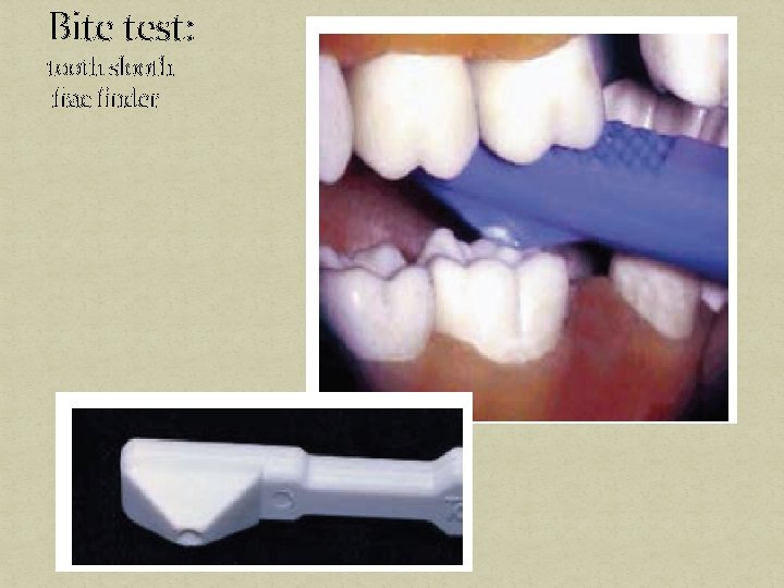 Bite test: tooth slooth frac finder 
