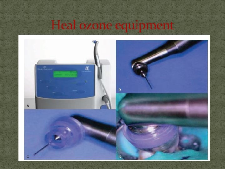 Heal ozone equipment 