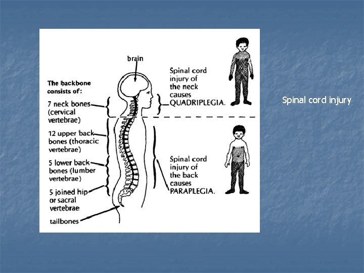 Spinal cord injury 