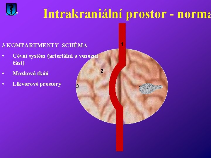 Intrakraniální prostor - norma 1 3 KOMPARTMENTY SCHÉMA • Cévní systém (arteriální a venózní