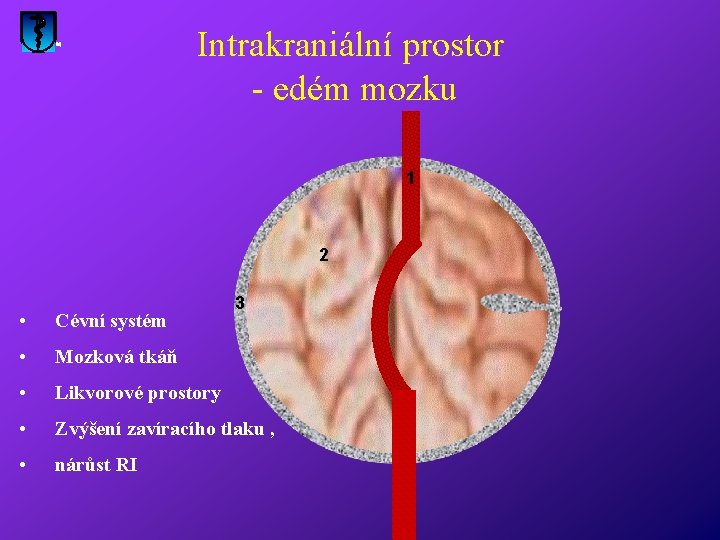 Intrakraniální prostor - edém mozku 1 2 3 • Cévní systém • Mozková tkáň