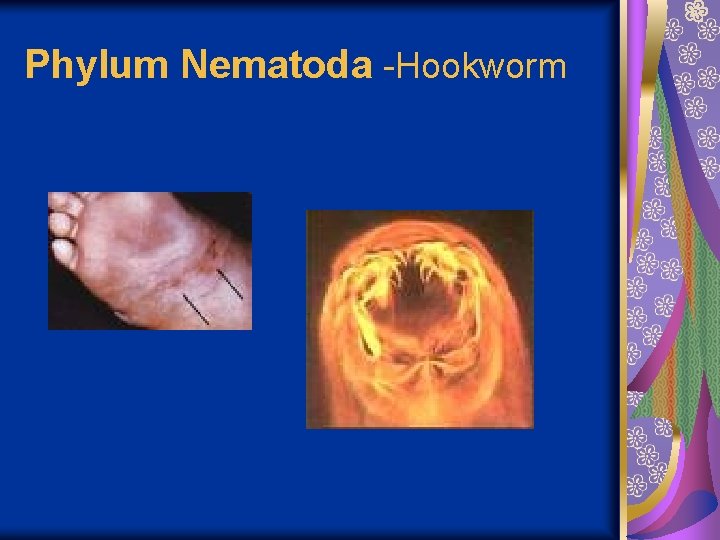 Phylum Nematoda -Hookworm 
