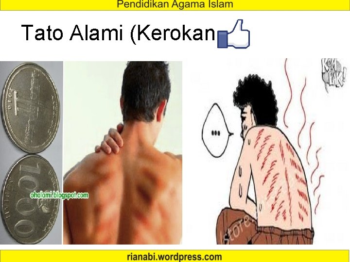 Tato Alami (Kerokan) 