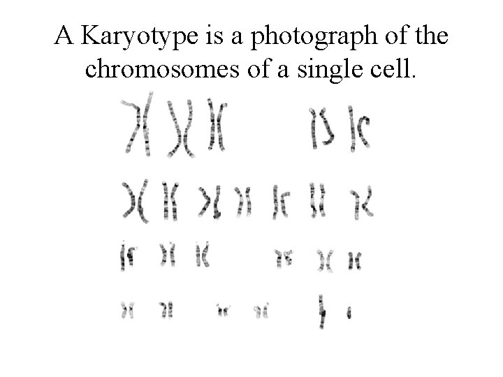 A Karyotype is a photograph of the chromosomes of a single cell. 