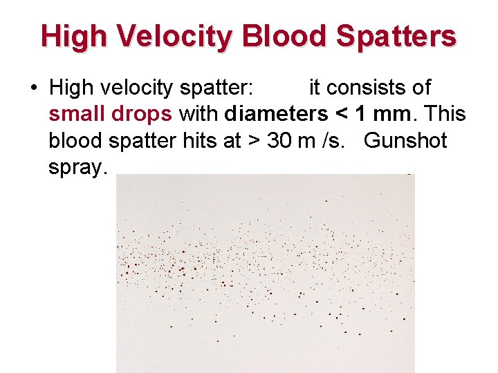 High Velocity Blood Spatters • High velocity spatter: it consists of small drops with High Velocity Blood Spatters • High velocity spatter: it consists of small drops with