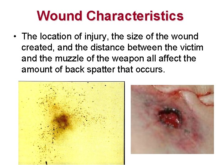 Wound Characteristics • The location of injury, the size of the wound created, and Wound Characteristics • The location of injury, the size of the wound created, and