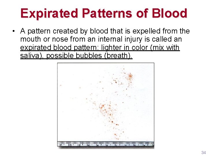 Expirated Patterns of Blood • A pattern created by blood that is expelled from Expirated Patterns of Blood • A pattern created by blood that is expelled from