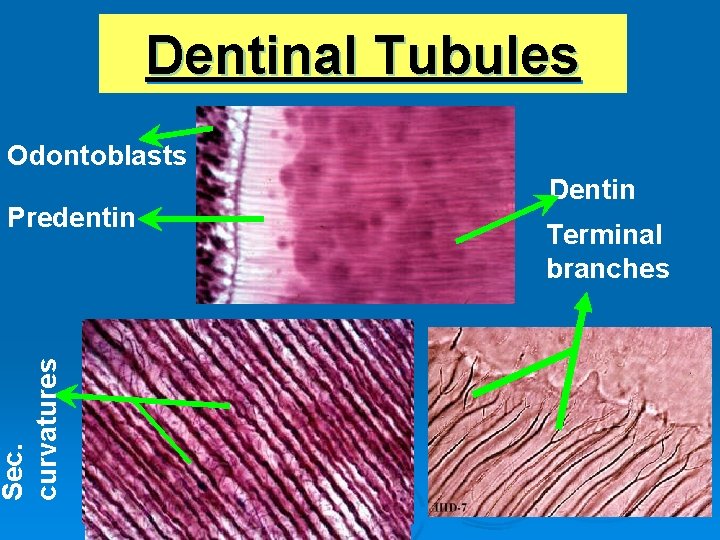 Dentinal Tubules Odontoblasts Sec. curvatures Predentin Dentin Terminal branches 