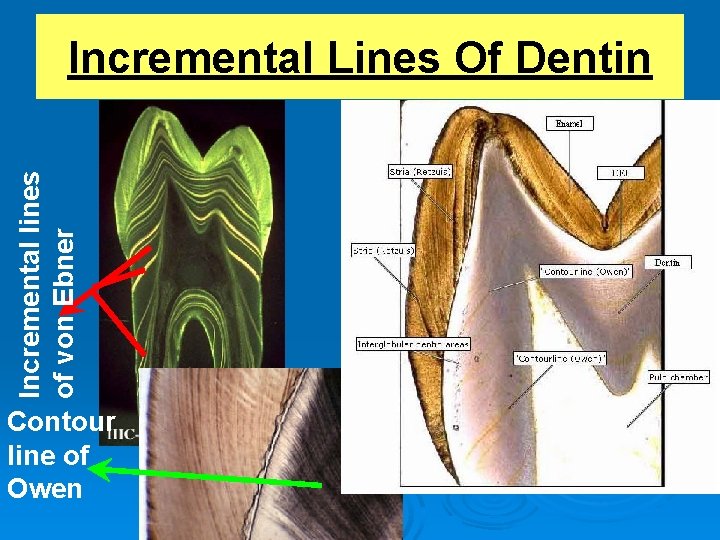 Incremental lines of von Ebner Incremental Lines Of Dentin Contour line of Owen 