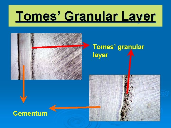 Tomes’ Granular Layer Tomes’ granular layer Cementum 
