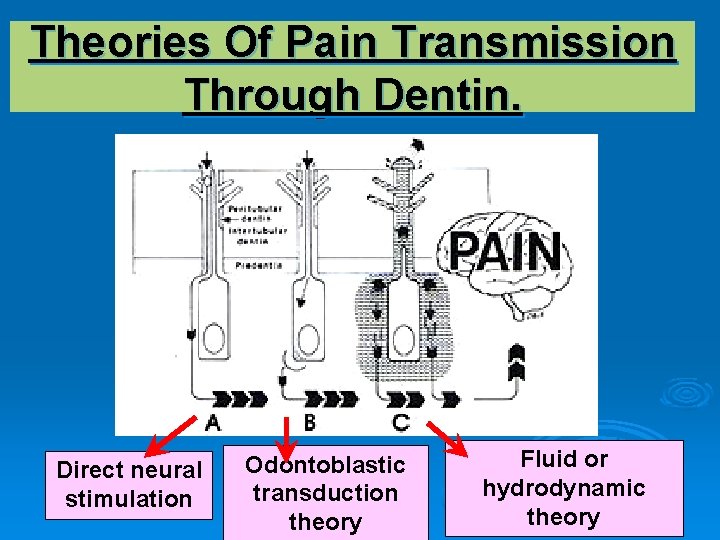 Theories Of Pain Transmission Through Dentin. Direct neural stimulation Odontoblastic transduction theory Fluid or