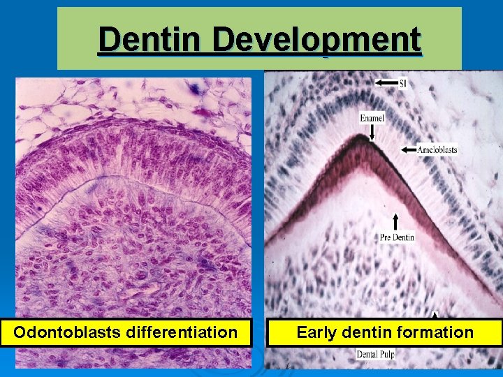 Dentin Development Odontoblasts differentiation Early dentin formation 