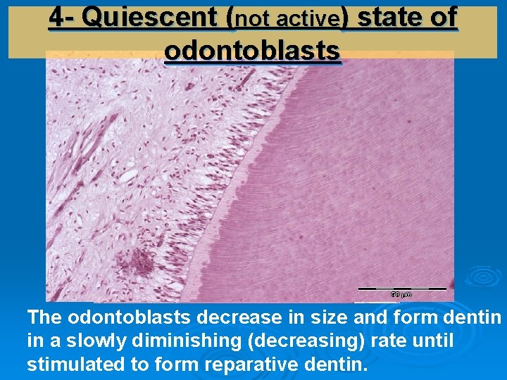 4 - Quiescent (not active) state of odontoblasts The odontoblasts decrease in size and