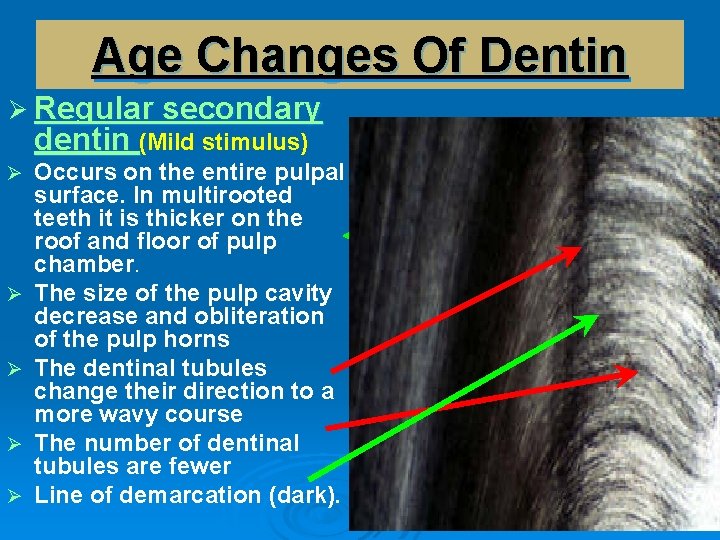 Age Changes Of Dentin Ø Regular secondary dentin (Mild stimulus) Ø Ø Ø Occurs