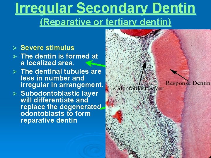 Irregular Secondary Dentin (Reparative or tertiary dentin) Severe stimulus The dentin is formed at