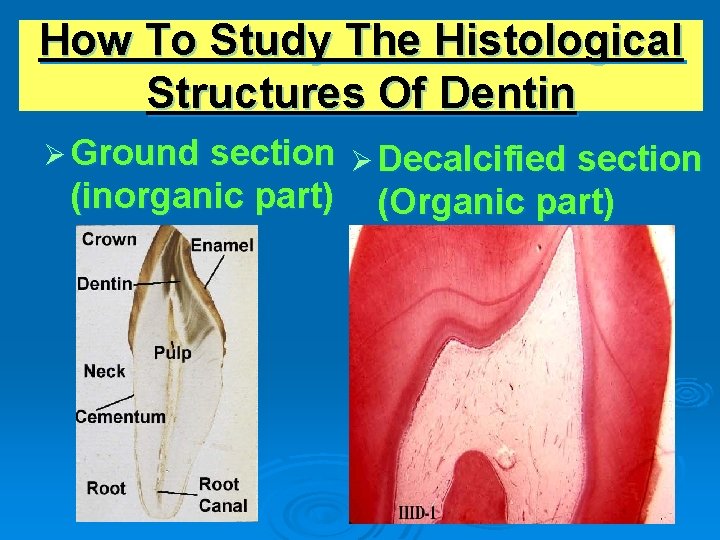 How To Study The Histological Structures Of Dentin Ø Ground section Ø Decalcified section
