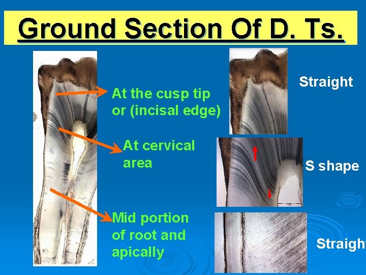 Ground Section Of D. Ts. At the cusp tip or (incisal edge) At cervical