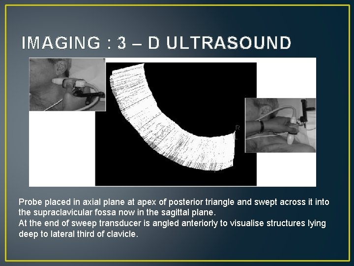IMAGING : 3 – D ULTRASOUND Probe placed in axial plane at apex of