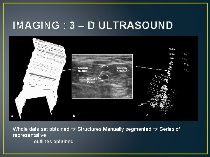 IMAGING : 3 – D ULTRASOUND Whole data set obtained Structures Manually segmented Series