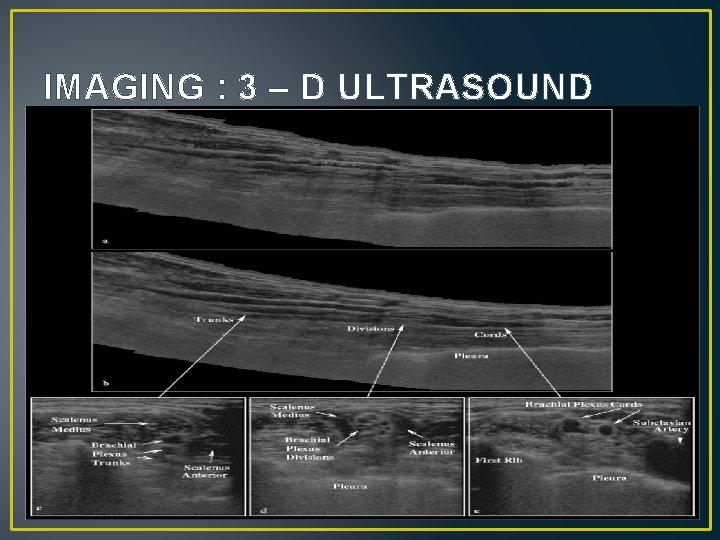IMAGING : 3 – D ULTRASOUND 