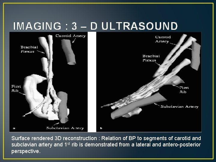 IMAGING : 3 – D ULTRASOUND Surface rendered 3 D reconstruction : Relation of