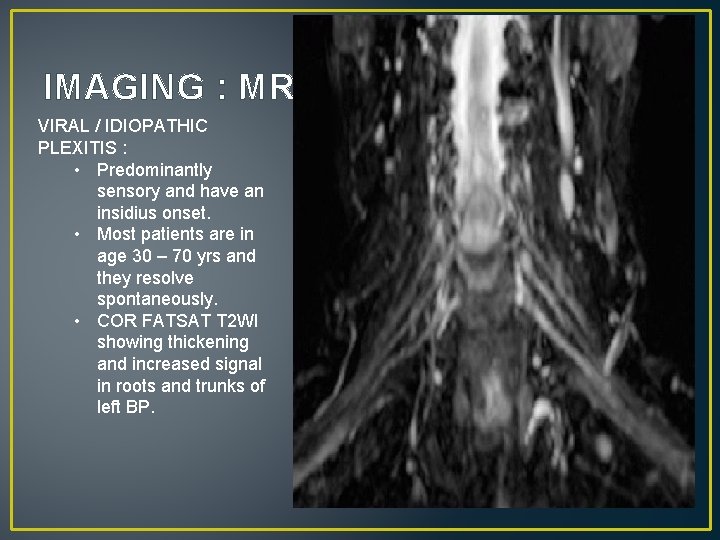 IMAGING : MRI VIRAL / IDIOPATHIC PLEXITIS : • Predominantly sensory and have an