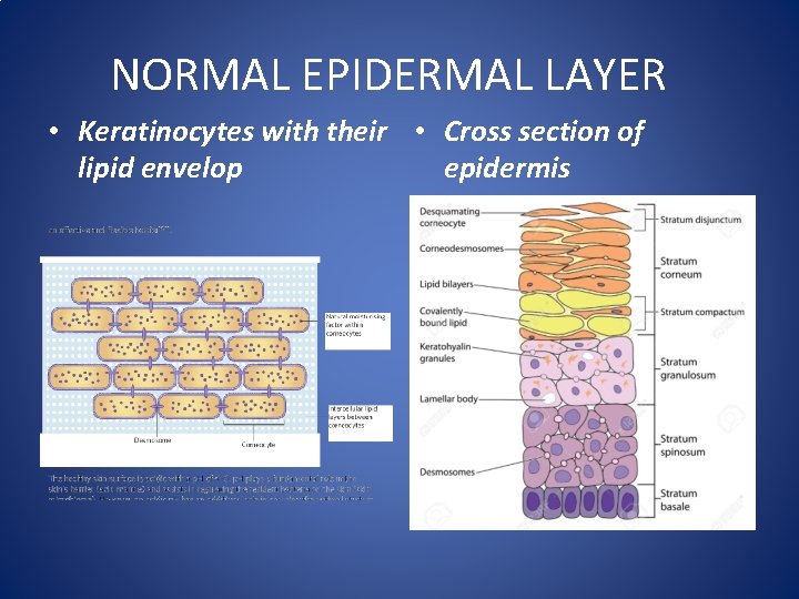 NORMAL EPIDERMAL LAYER • Keratinocytes with their • Cross section of lipid envelop epidermis