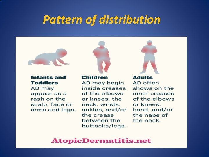 Pattern of distribution 