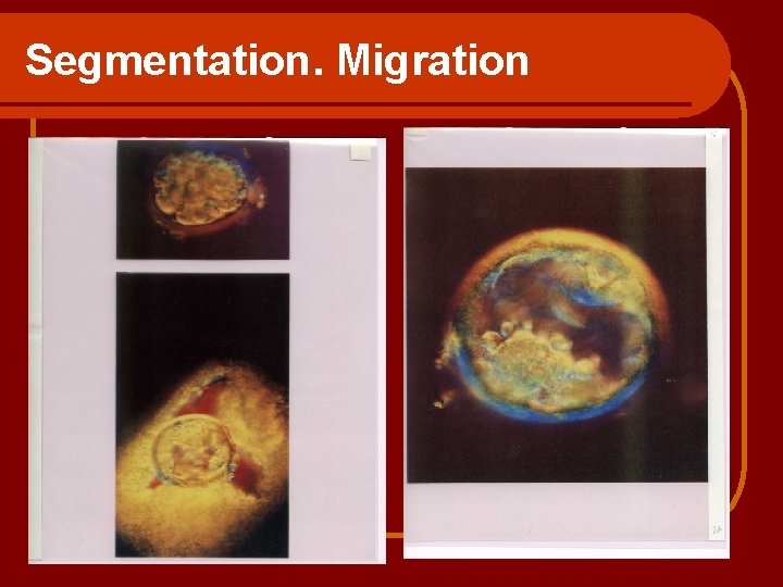 Segmentation. Migration 