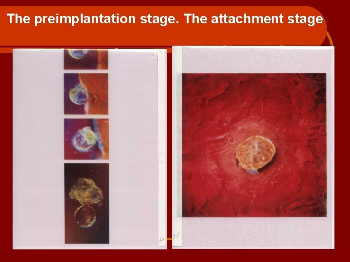 The preimplantation stage. The attachment stage 