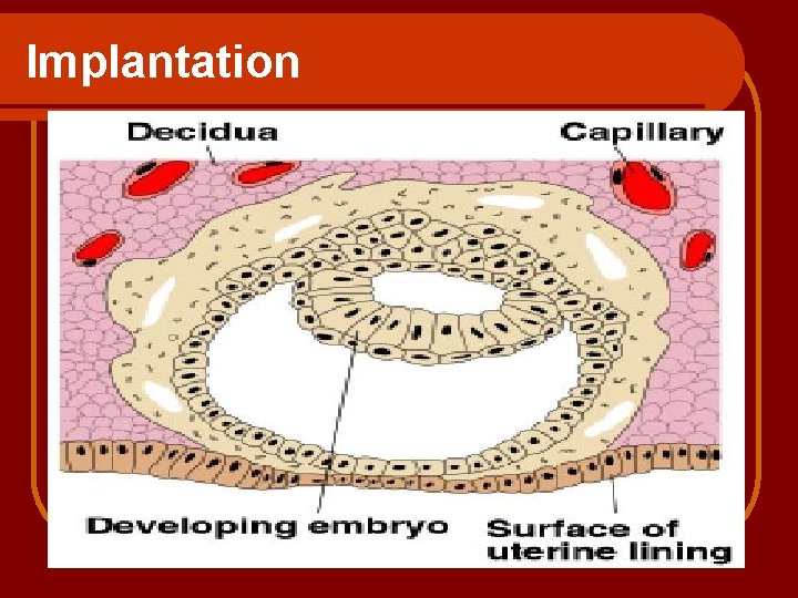 Implantation 